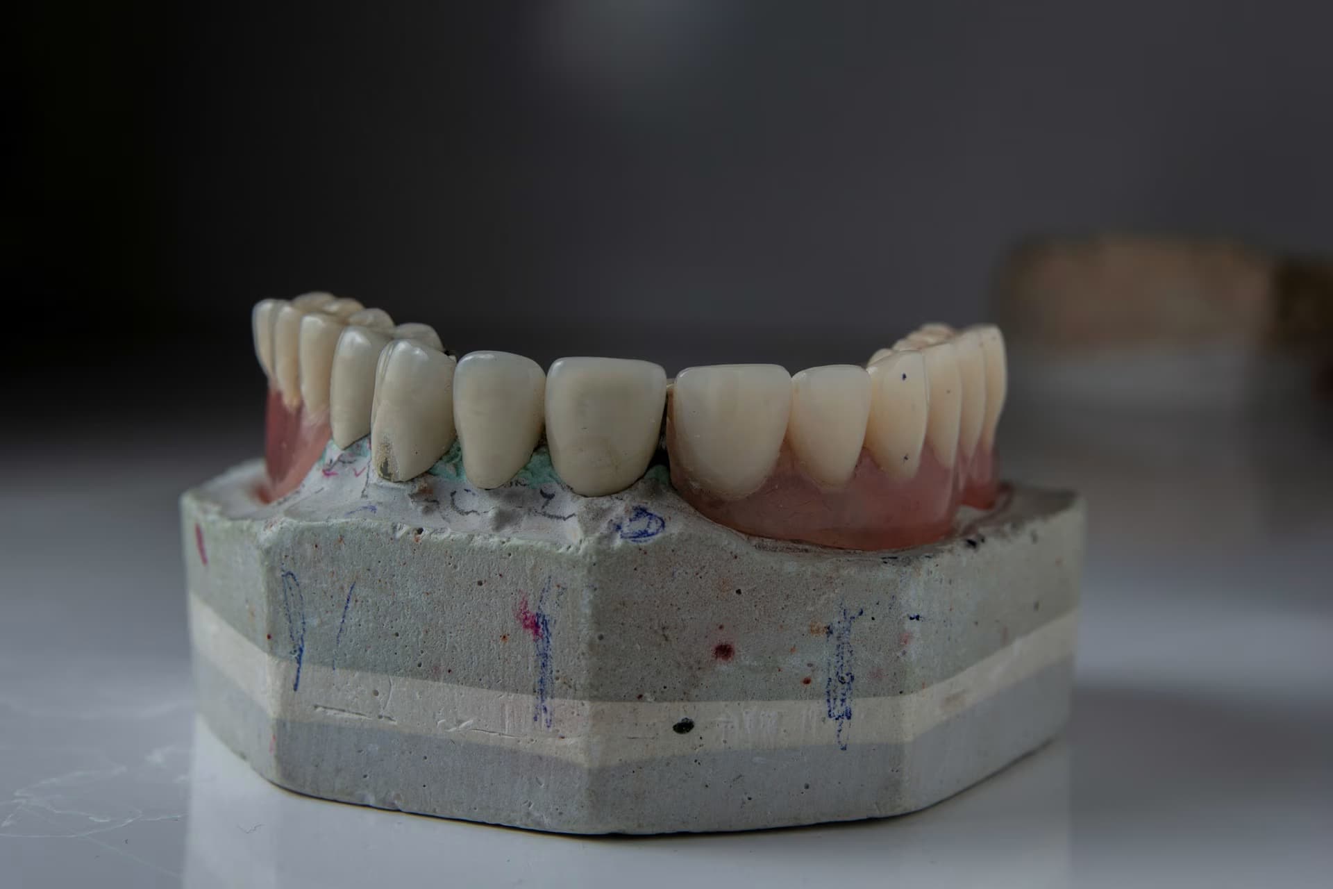 Complete dentures Oshawa