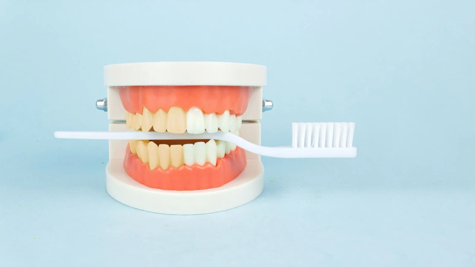 Dental Bonding Services in Oshawa - Groot Dental