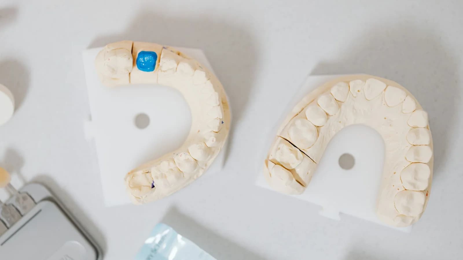 Dental Crowns & Bridges: Restoring Your Complete Smile