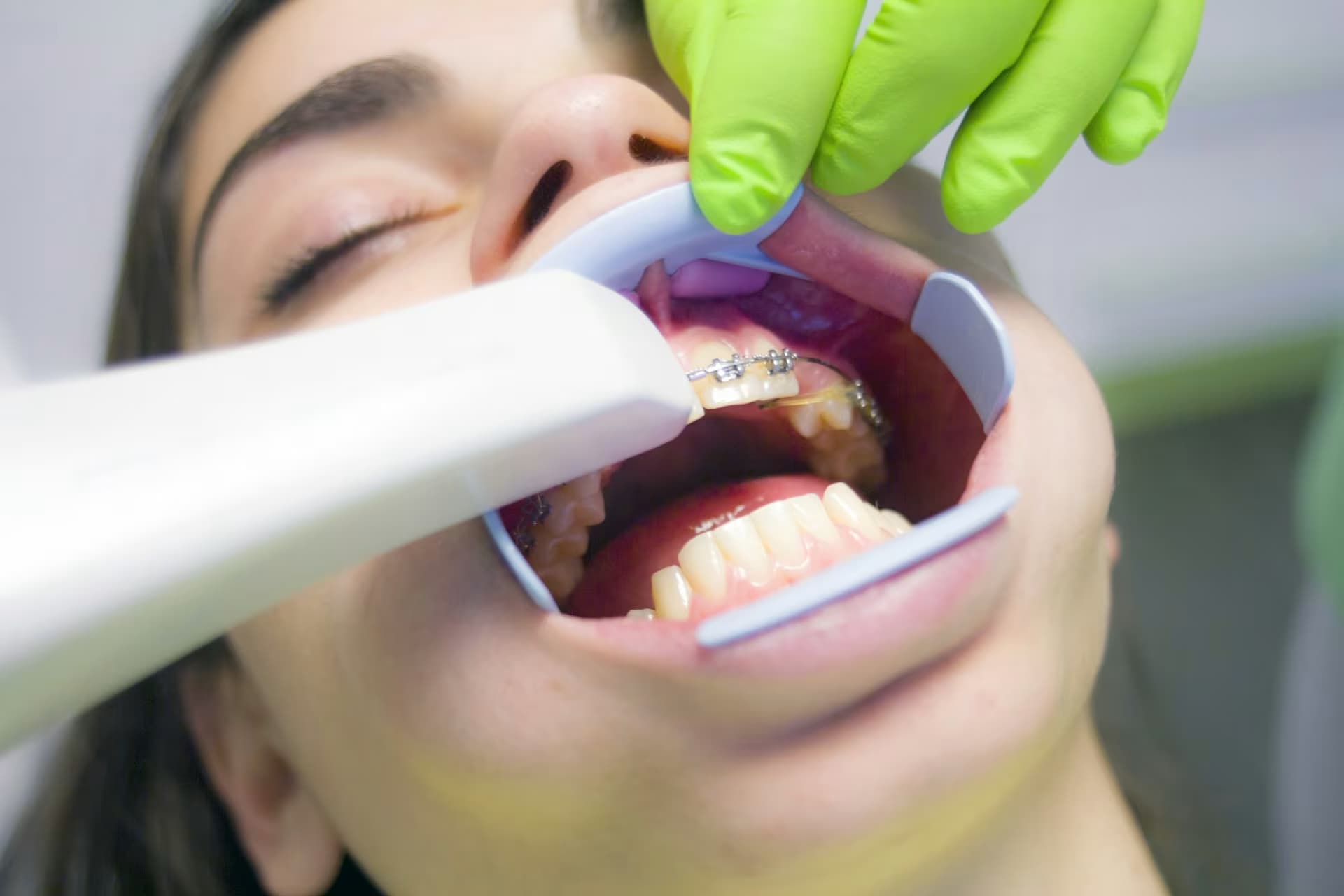 Advanced orthodontic solutions in O'Neill