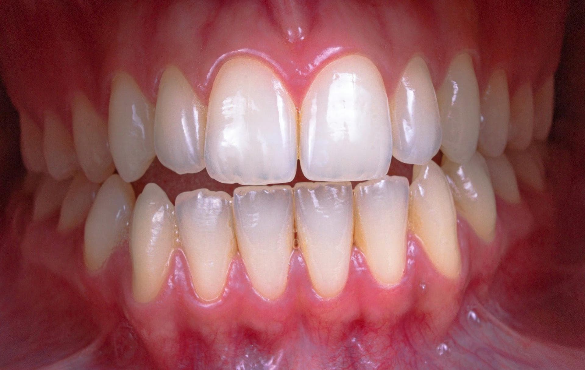 Groot Dental Blog Image