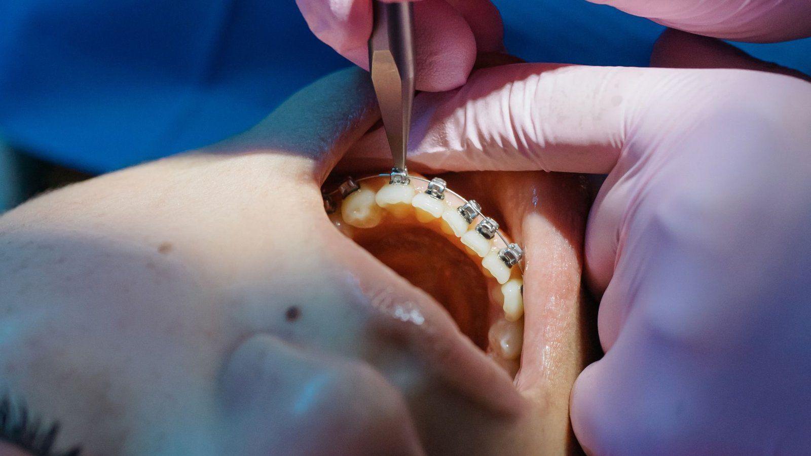 Is Sedation Dentistry Safe for Children? A Parent’s Guide