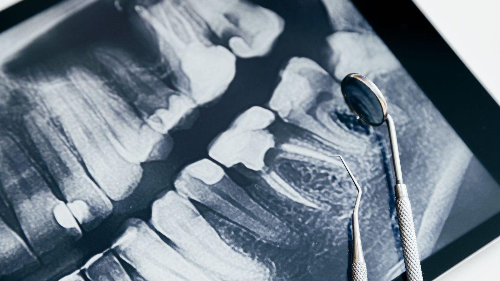 Dental X-Ray Services: A Key Component of Comprehensive Dentistry
