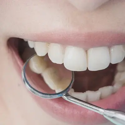 Hygiene Services: Promoting Oral Health and Preventing Disease