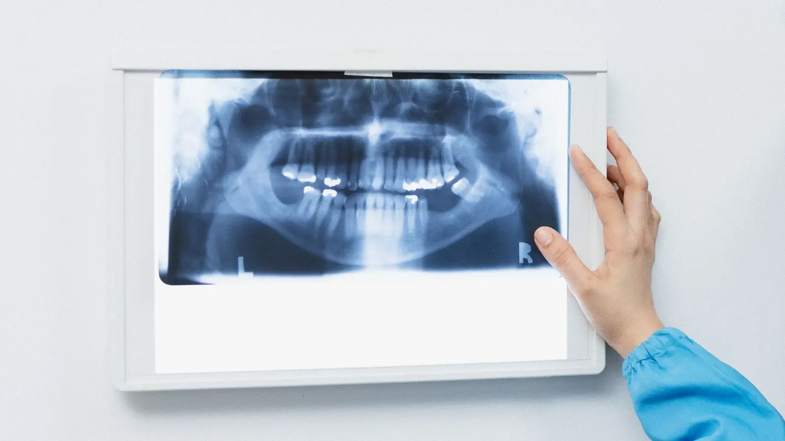 Advanced Dental X-Rays in Oshawa - Groot Dental