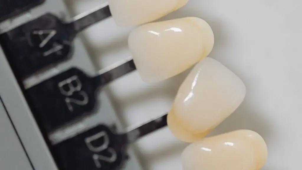 Expert smile design and veneer application in Oshawa