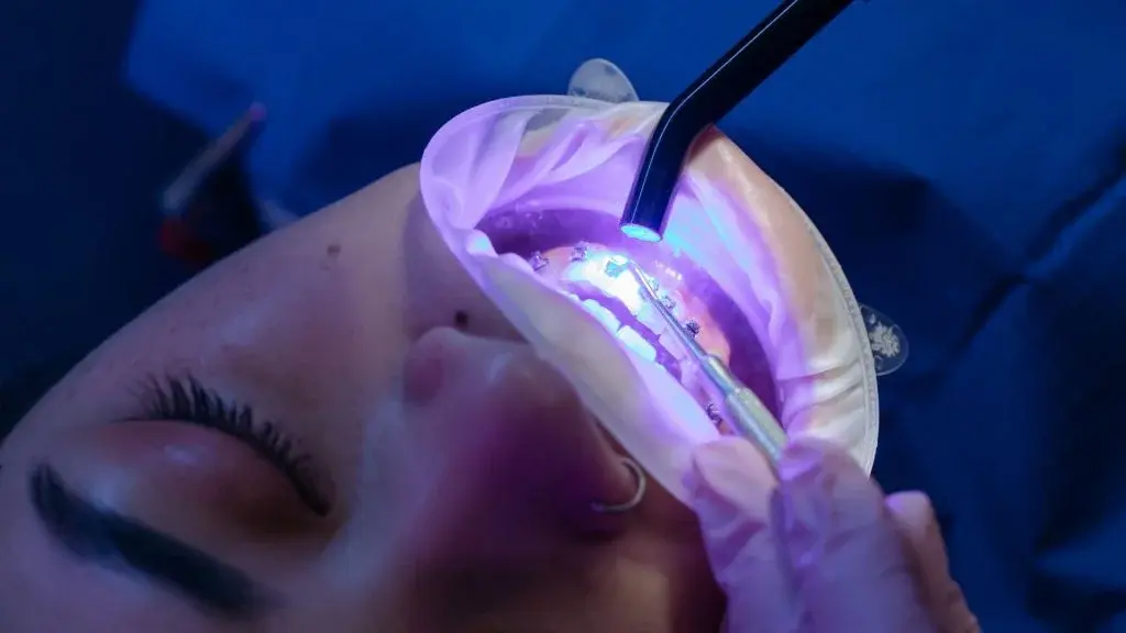 Personalized orthodontic treatment planning Oshawa