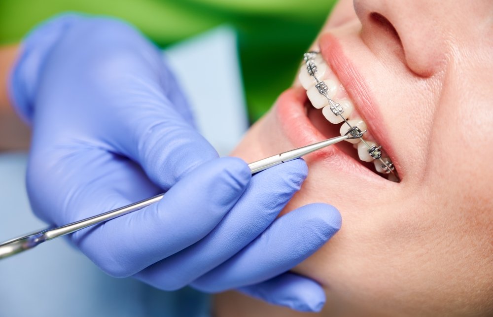 Orthodontics in Oshawa