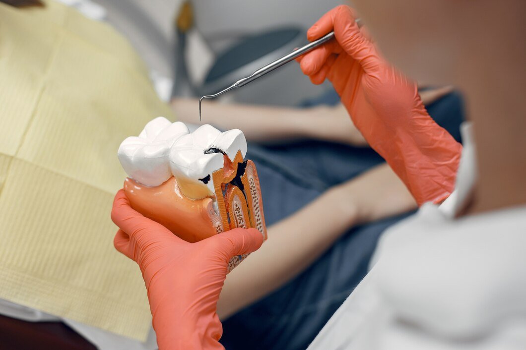 Teeth extraction